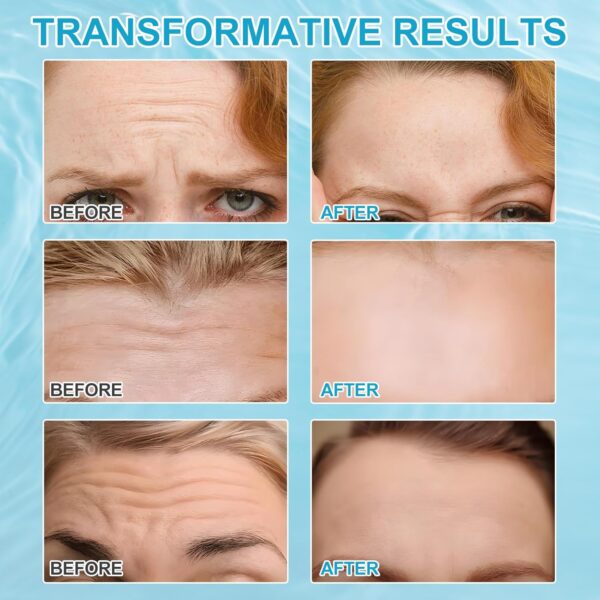 Wrinkle Anti-Falten-Pflaster für die Vorderseite, 12 Stück, Gesichtslifting – pflegende Mischung aus Kollagen und Vitamin E zur Reduzierung von Falten und zur endgültigen Wiederherstellung der Haut – Bild 5