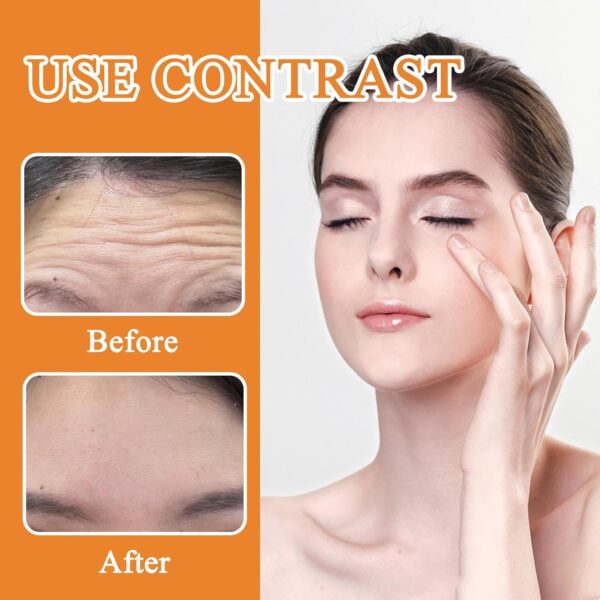 20 Stück Zornesfalte Pflaster, Zornesfalte Pflaster Anti Falten, Anti Falten Pflaster, Stirn Pads Gegen Falten, Forehead Wrinkle Patch,Anti Falten Stirn Pad,Feuchtigkeit Anti-Aging Zornesfalte Patches – Bild 4