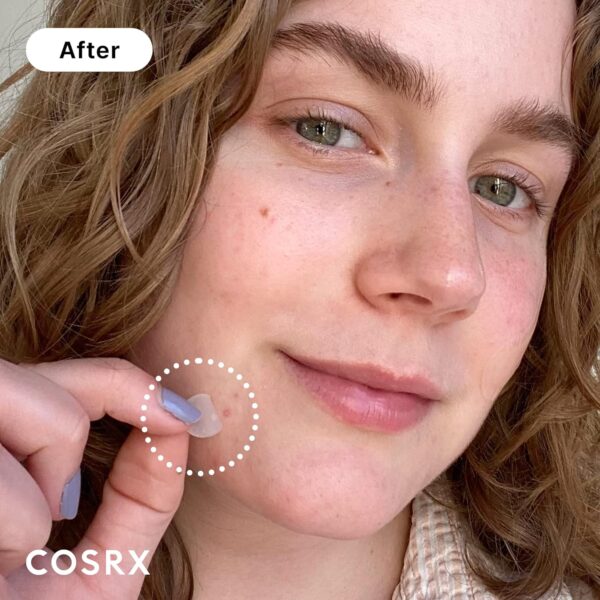 COSRX Master Patch Original Fit 96 Stück - 4 Packungen, Anti Pickel Patches, gegen Pickel und Unreinheiten, Acne Pimple Patches, Intensive Behandlung, Hydrokolloid Pflaster gesicht, 3 Größen – Bild 2